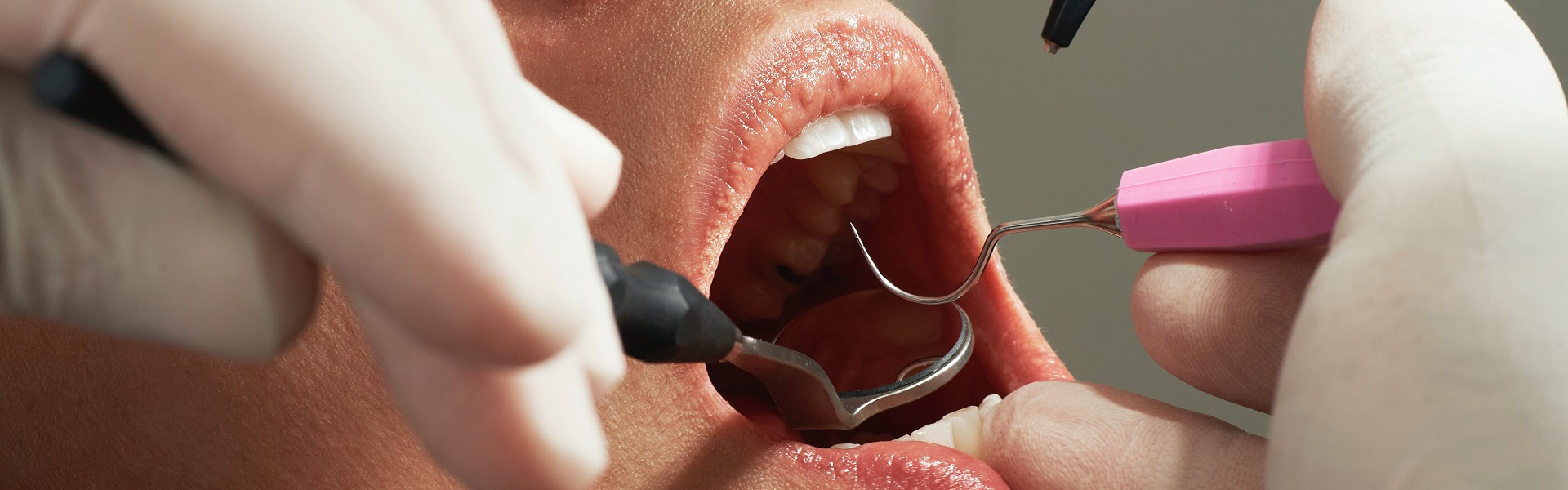 Zubna Tehnika| Stomatolog Kragujevac
