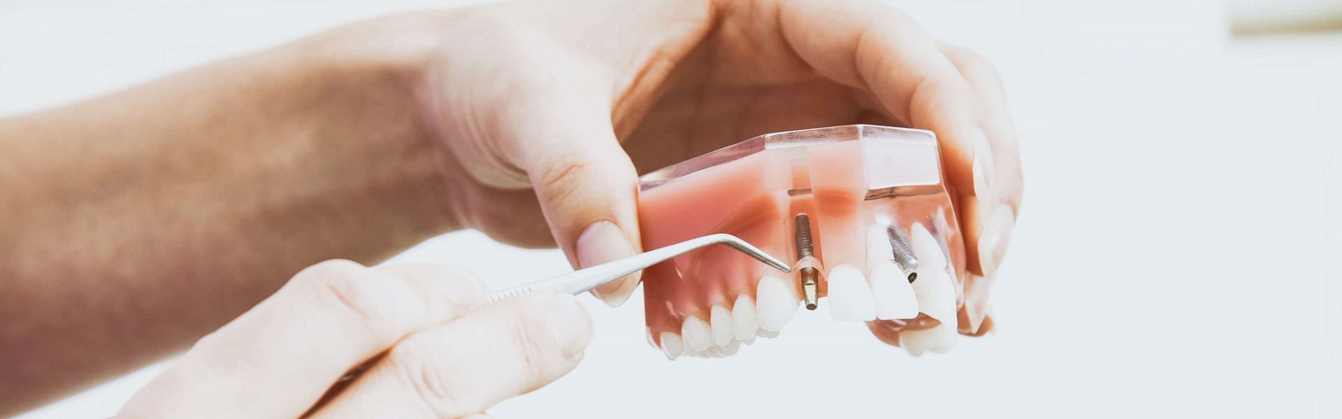Zubna Tehnika| Zubna tehnika